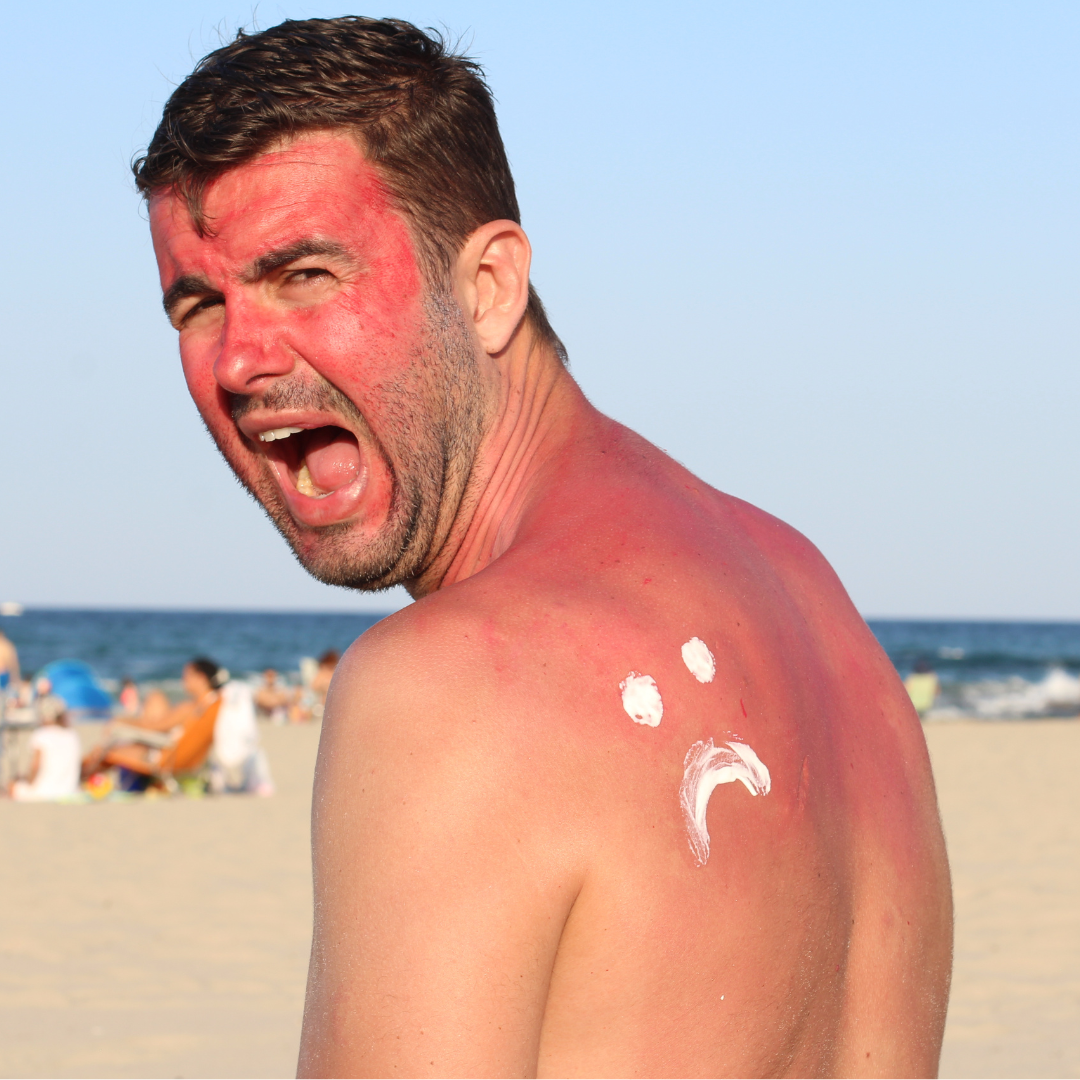 Eat this and sunburn less? Check out what the science says.